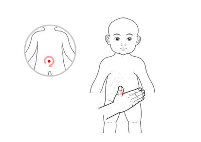 小兒推拿治療感冒嗎？